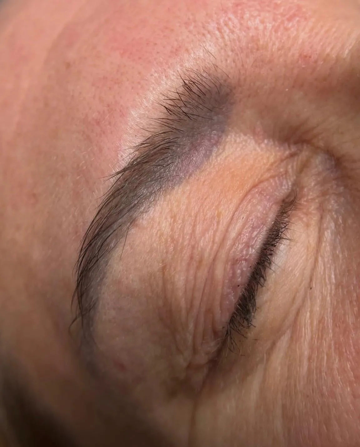 Augenbraue mit altem Permanent Make-up vor der Laserbehandlung
