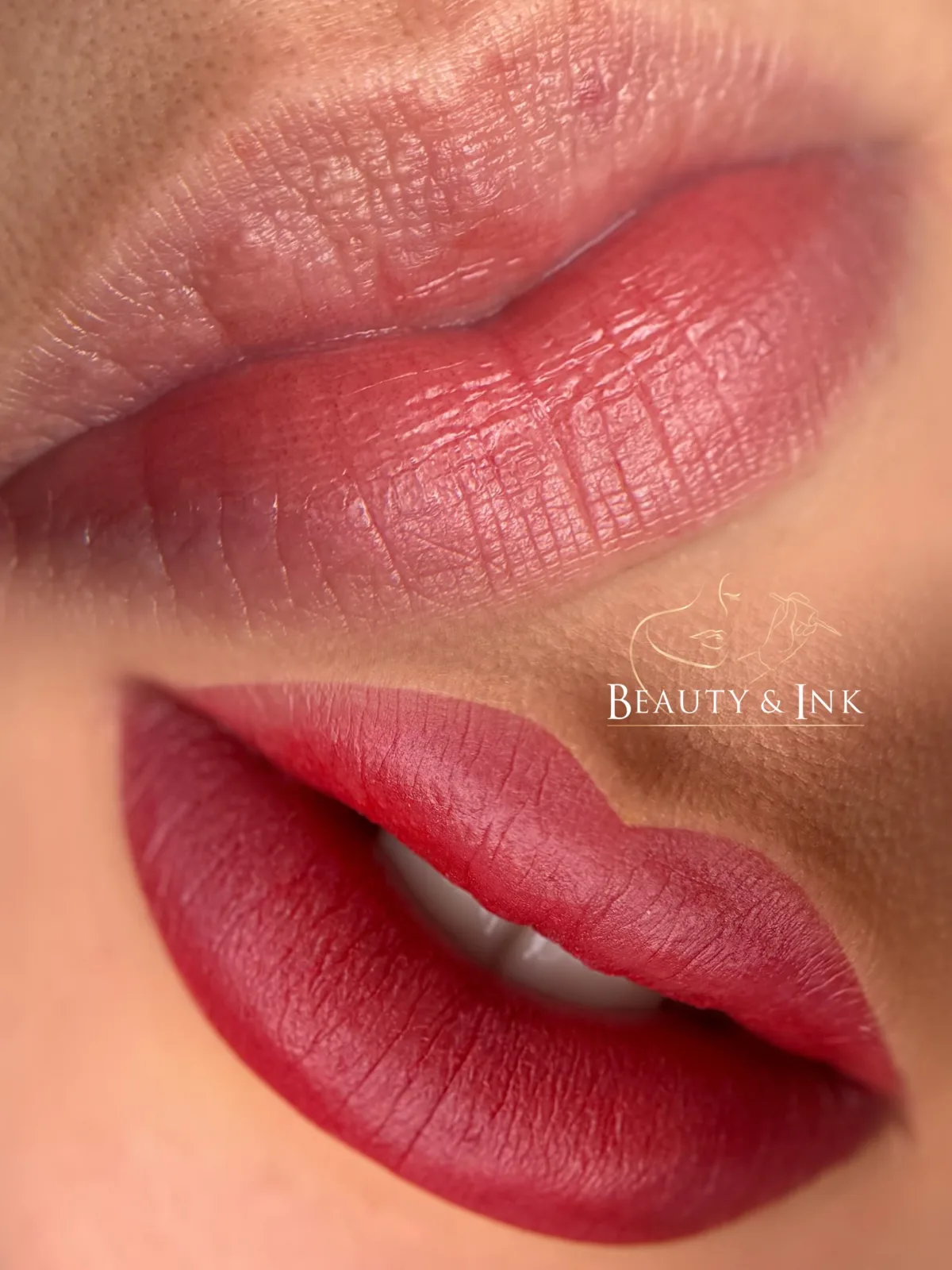 Lippenpigmentierung im Detail